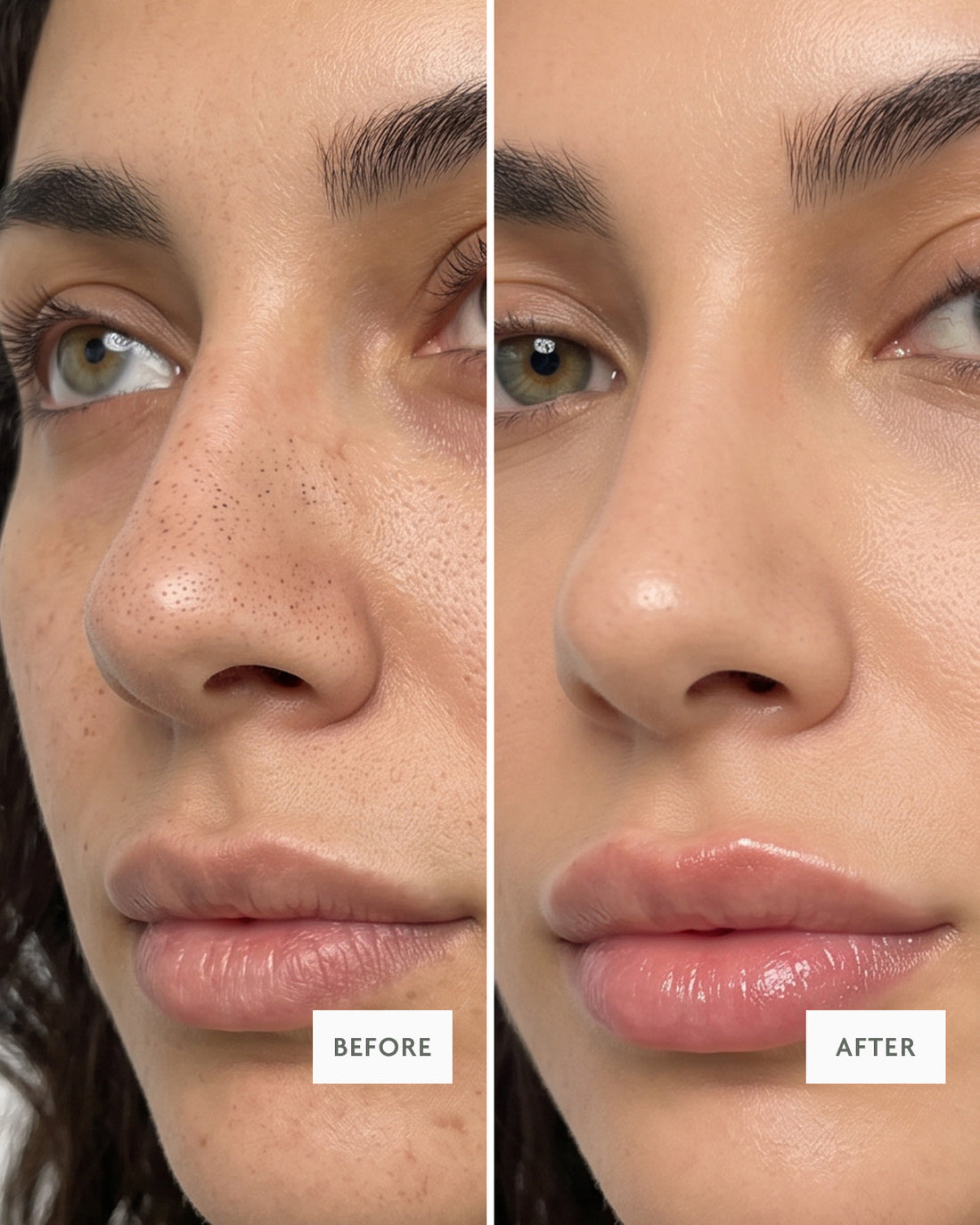 Close-up before and after of clearer, less congested pores on the nose