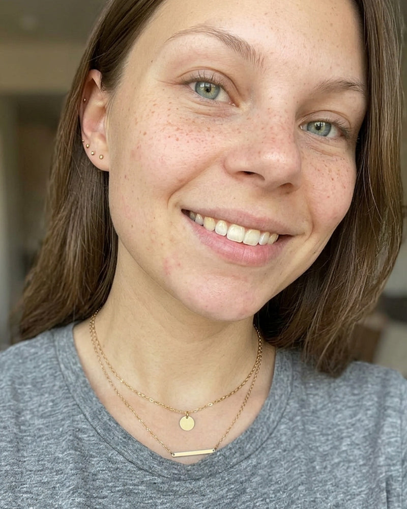 Clearer chin after using KYLA chin patches
